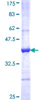 Kv10.1 / KCNG3 Protein - 12.5% SDS-PAGE Stained with Coomassie Blue.