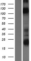 Kv10.1 / KCNH1 Protein - Western validation with an anti-DDK antibody * L: Control HEK293 lysate R: Over-expression lysate