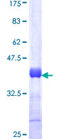 Kv10.1 / KCNH1 Protein - 12.5% SDS-PAGE Stained with Coomassie Blue.