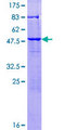 KXD1 / C19orf50 Protein - 12.5% SDS-PAGE of human MGC2749 stained with Coomassie Blue