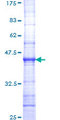 L1CAM Protein - 12.5% SDS-PAGE Stained with Coomassie Blue.