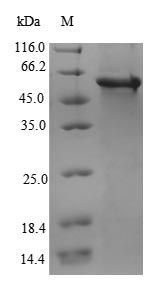 L2HGDH Protein - (Tris-Glycine gel) Discontinuous SDS-PAGE (reduced) with 5% enrichment gel and 15% separation gel.