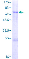 L2HGDH Protein - 12.5% SDS-PAGE of human L2HGDH stained with Coomassie Blue