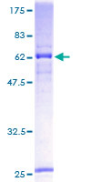 L3 / LASS2 Protein - 12.5% SDS-PAGE of human LASS2 stained with Coomassie Blue