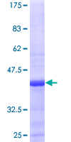 L35A / RPL35A Protein - 12.5% SDS-PAGE of human RPL35A stained with Coomassie Blue