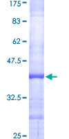 L35A / RPL35A Protein - 12.5% SDS-PAGE Stained with Coomassie Blue.