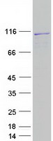 L3MBTL1 Protein - Purified recombinant protein L3MBTL1 was analyzed by SDS-PAGE gel and Coomassie Blue Staining