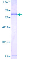 LACC1 Protein - 12.5% SDS-PAGE of human FLJ38725 stained with Coomassie Blue