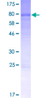 LACE1 Protein - 12.5% SDS-PAGE of human LACE1 stained with Coomassie Blue
