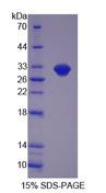 LACTB Protein - Recombinant  Lactamase Beta By SDS-PAGE