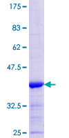 LAD1 Protein - 12.5% SDS-PAGE Stained with Coomassie Blue.