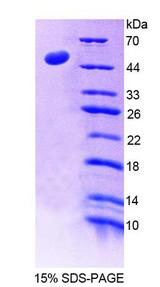 LAD1 Protein - Recombinant Ladinin 1 By SDS-PAGE