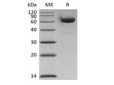 LAG3 Protein - Recombinant Human LAG-3/CD233 (C-6His-Avi) Biotinylated