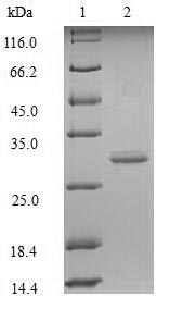 LAG3 Protein - (Tris-Glycine gel) Discontinuous SDS-PAGE (reduced) with 5% enrichment gel and 15% separation gel.