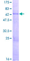 LAG3 Protein - 12.5% SDS-PAGE of human LAG3 stained with Coomassie Blue