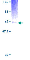 LAIR1 / CD305 Protein - 12.5% SDS-PAGE of human LAIR1 stained with Coomassie Blue