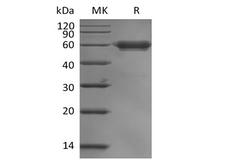 LAIR1 / CD305 Protein - Recombinant Human Leukocyte-associated Immunoglobulin-like Receptor 1/LAIR1/CD305 (C-mFc)