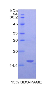 LAIR2 / CD306 Protein - Recombinant Leukocyte Associated Immunoglobulin Like Receptor 2 By SDS-PAGE