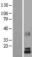 LALBA / Alpha Lactalbumin Protein - Western validation with an anti-DDK antibody * L: Control HEK293 lysate R: Over-expression lysate