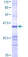 LALBA / Alpha Lactalbumin Protein - 12.5% SDS-PAGE Stained with Coomassie Blue.