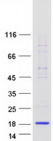 LALBA / Alpha Lactalbumin Protein - Purified recombinant protein LALBA was analyzed by SDS-PAGE gel and Coomassie Blue Staining