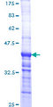 LAMA2 / Merosin Protein - 12.5% SDS-PAGE Stained with Coomassie Blue.