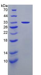 LAMA3 / Laminin Alpha 3 Protein - Recombinant Laminin Alpha 3 By SDS-PAGE