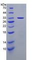 LAMA3 / Laminin Alpha 3 Protein - Recombinant Laminin Alpha 3 By SDS-PAGE