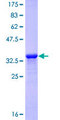 LAMA3 / Laminin Alpha 3 Protein - 12.5% SDS-PAGE Stained with Coomassie Blue.