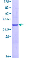 LAMA4 / Laminin Alpha 4 Protein - 12.5% SDS-PAGE of human LAMA4 stained with Coomassie Blue