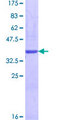 LAMA4 / Laminin Alpha 4 Protein - 12.5% SDS-PAGE of human LAMA4 stained with Coomassie Blue