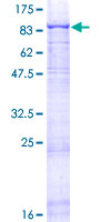 LAMA5 / Laminin Alpha 5 Protein - 12.5% SDS-PAGE of human LAMA5 stained with Coomassie Blue