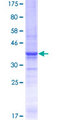 LAMA5 / Laminin Alpha 5 Protein - 12.5% SDS-PAGE Stained with Coomassie Blue.