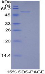 LAMB1 / Laminin Beta 1 Protein - Recombinant Laminin Beta 1 (LAMb1) by SDS-PAGE