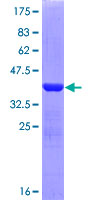 LAMB3 / Laminin Beta 3 Protein - 12.5% SDS-PAGE Stained with Coomassie Blue.