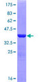 LAMB3 / Laminin Beta 3 Protein - 12.5% SDS-PAGE Stained with Coomassie Blue.