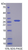 LAMB4 / Laminin Beta 4 Protein - Recombinant Laminin Beta 4 By SDS-PAGE