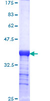 LAMC2 / Laminin Gamma 2 Protein - 12.5% SDS-PAGE Stained with Coomassie Blue.