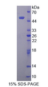 LAMC3 / Laminin Gamma 3 Protein - Recombinant  Laminin Gamma 3 By SDS-PAGE