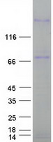 LAMC3 / Laminin Gamma 3 Protein - Purified recombinant protein LAMC3 was analyzed by SDS-PAGE gel and Coomassie Blue Staining