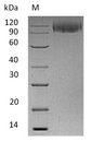 LAMP1 / CD107a Protein - (Tris-Glycine gel) Discontinuous SDS-PAGE (reduced) with 5% enrichment gel and 15% separation gel.