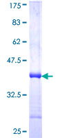 LAMP2 / CD107b Protein - 12.5% SDS-PAGE Stained with Coomassie Blue.