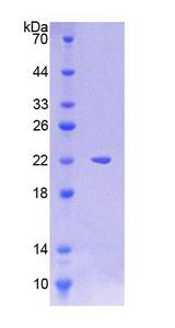 LAMP3 / CD208 Protein - Recombinant  Lysosomal Associated Membrane Protein 3 By SDS-PAGE