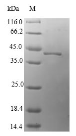 LAMTOR3 / MP1 Protein - (Tris-Glycine gel) Discontinuous SDS-PAGE (reduced) with 5% enrichment gel and 15% separation gel.