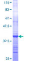 LAMTOR3 / MP1 Protein - 12.5% SDS-PAGE Stained with Coomassie Blue.