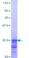 LANCL1 Protein - 12.5% SDS-PAGE Stained with Coomassie Blue.