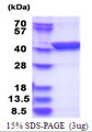 LANCL1 Protein