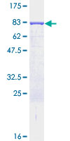 LAP3 Protein - 12.5% SDS-PAGE of human LAP3 stained with Coomassie Blue