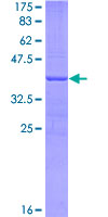 LAP3 Protein - 12.5% SDS-PAGE Stained with Coomassie Blue.