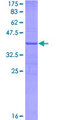 LAP3 Protein - 12.5% SDS-PAGE Stained with Coomassie Blue.